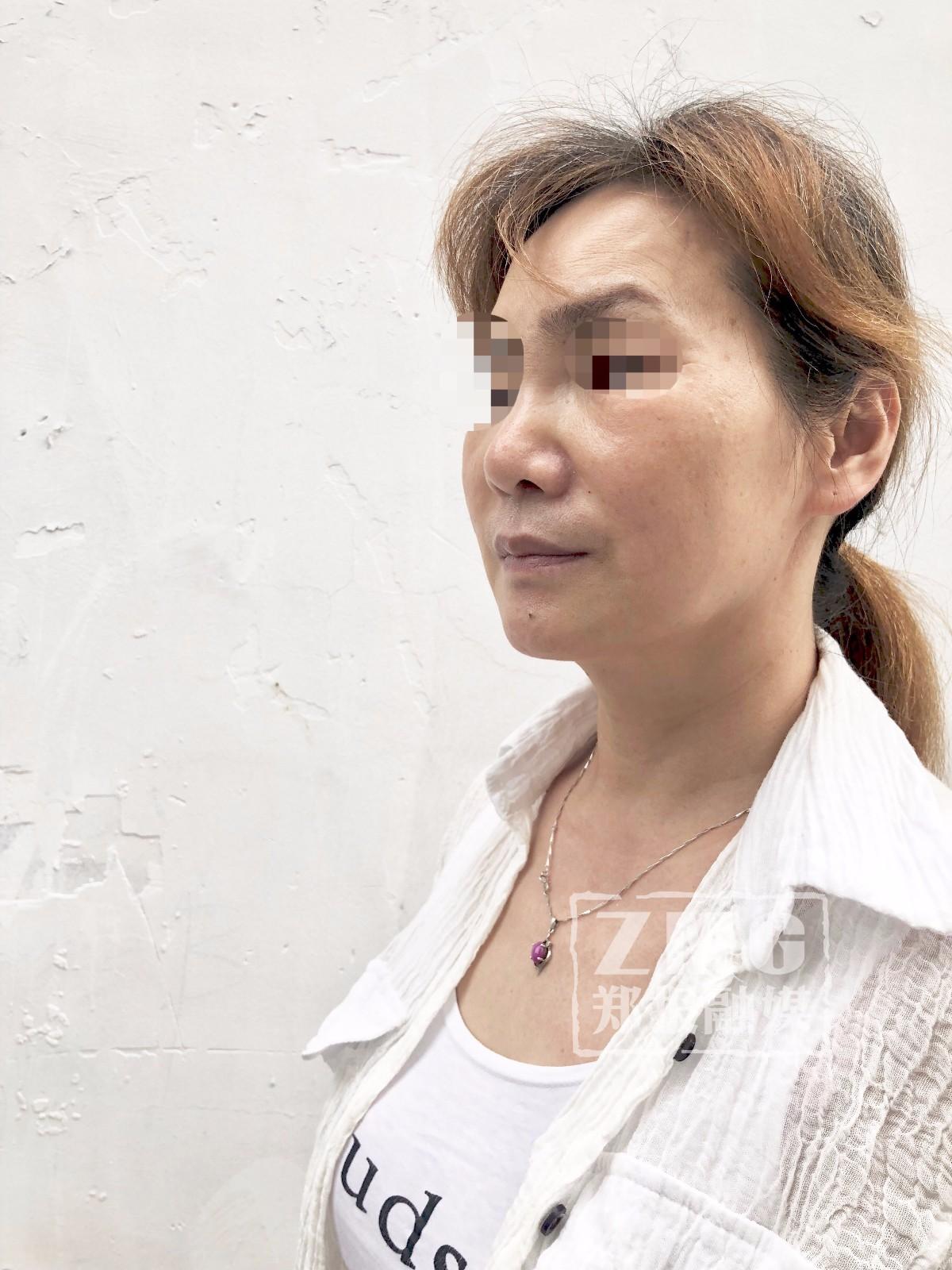 揭秘最新隆鼻黑科技，塑造完美鼻梁，瞬间惊艳全场！